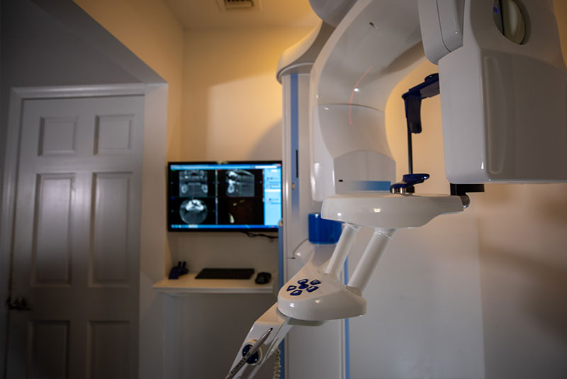 Long Island Implant and Cosmetic Dentistry 3D Cone Beam Scanner
